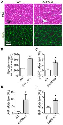 <mark class="highlighted">Galanin</mark> Regulates Myocardial Mitochondrial ROS Homeostasis and Hypertrophic Remodeling Through GalR2